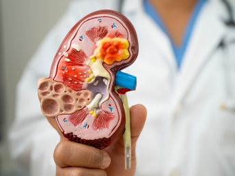 dr. carlos arturo gonzalez gonzalez urología especializada manejo de litiasis urinaria cálculos en riñón, uréter y vejiga
