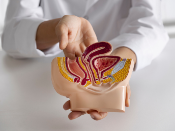 Dr. Carlos Arturo Gonzalez Gonzalez - Urología Especializada - Varicocele